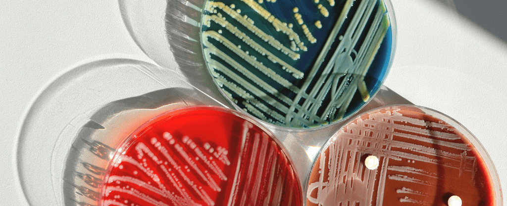 razones test microbiota